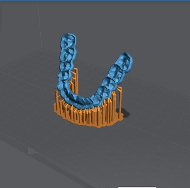 Dental model supported at an angle